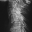 Radiographie standard de la colonne cervicale (...)